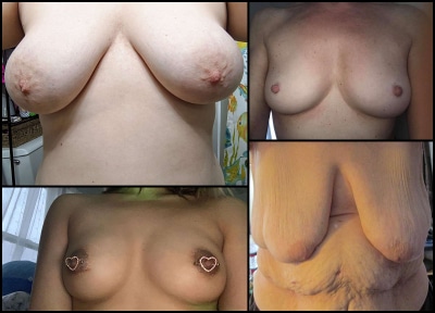 breast-blog_0007